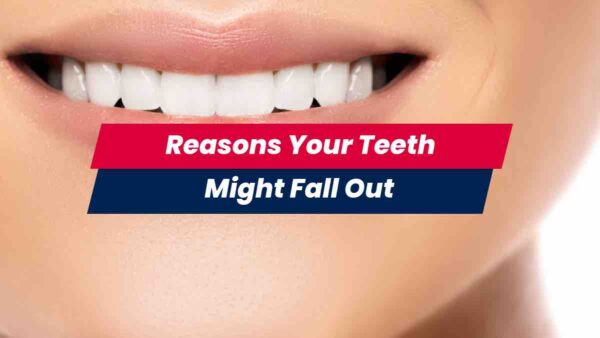 reasons-your-teeth-might-fall-out